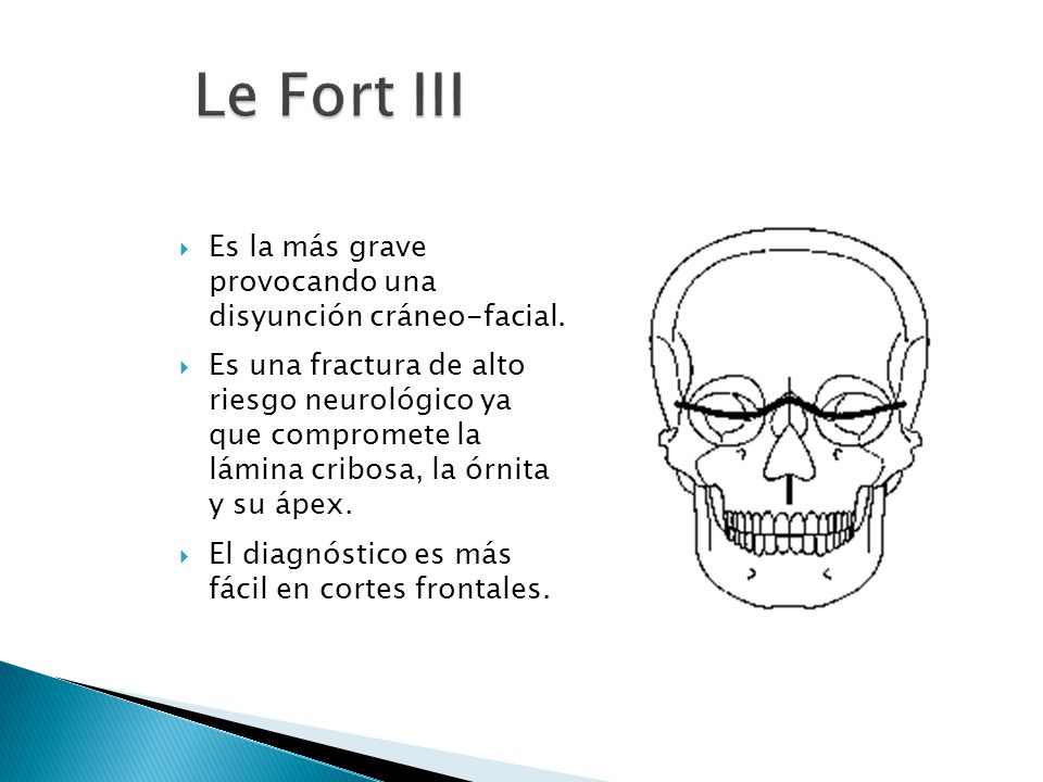lefort fracturas